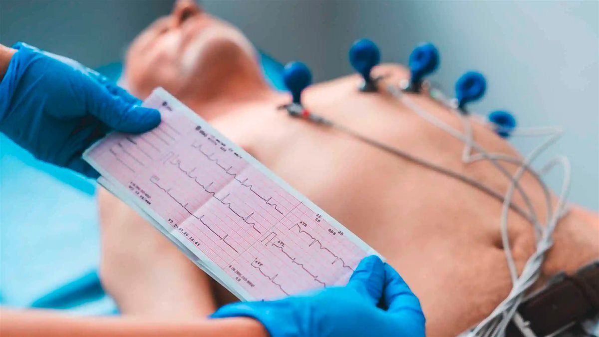 Eletrodos utilizados no eletrocardiograma