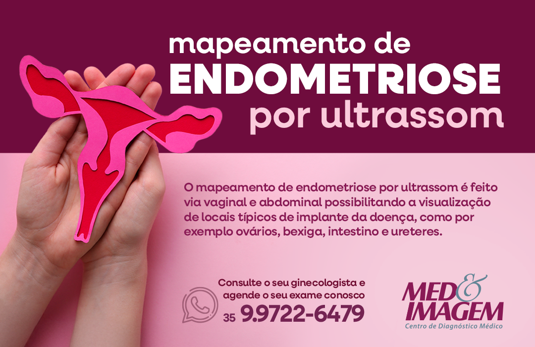 Imagem responsiva